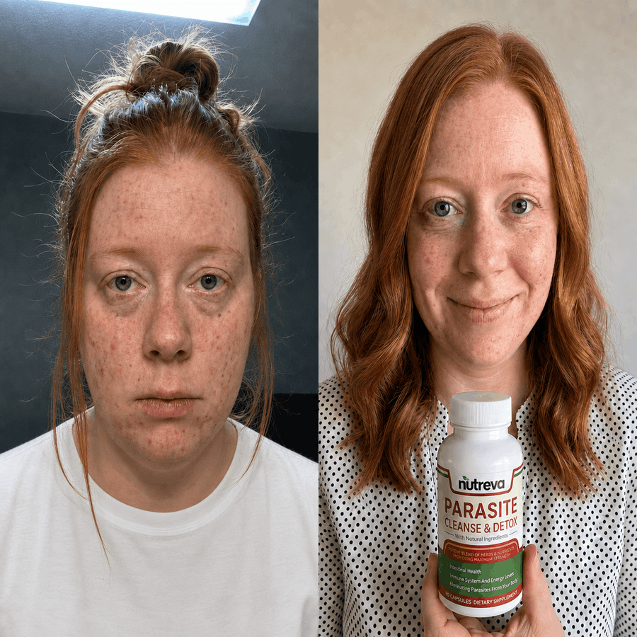 Side by side of a red-haired woman, before and after, holding a Nutreva bottle
