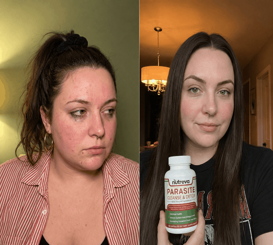 Side by side of a dark-haired woman, before and after, holding a Nutreva bottle